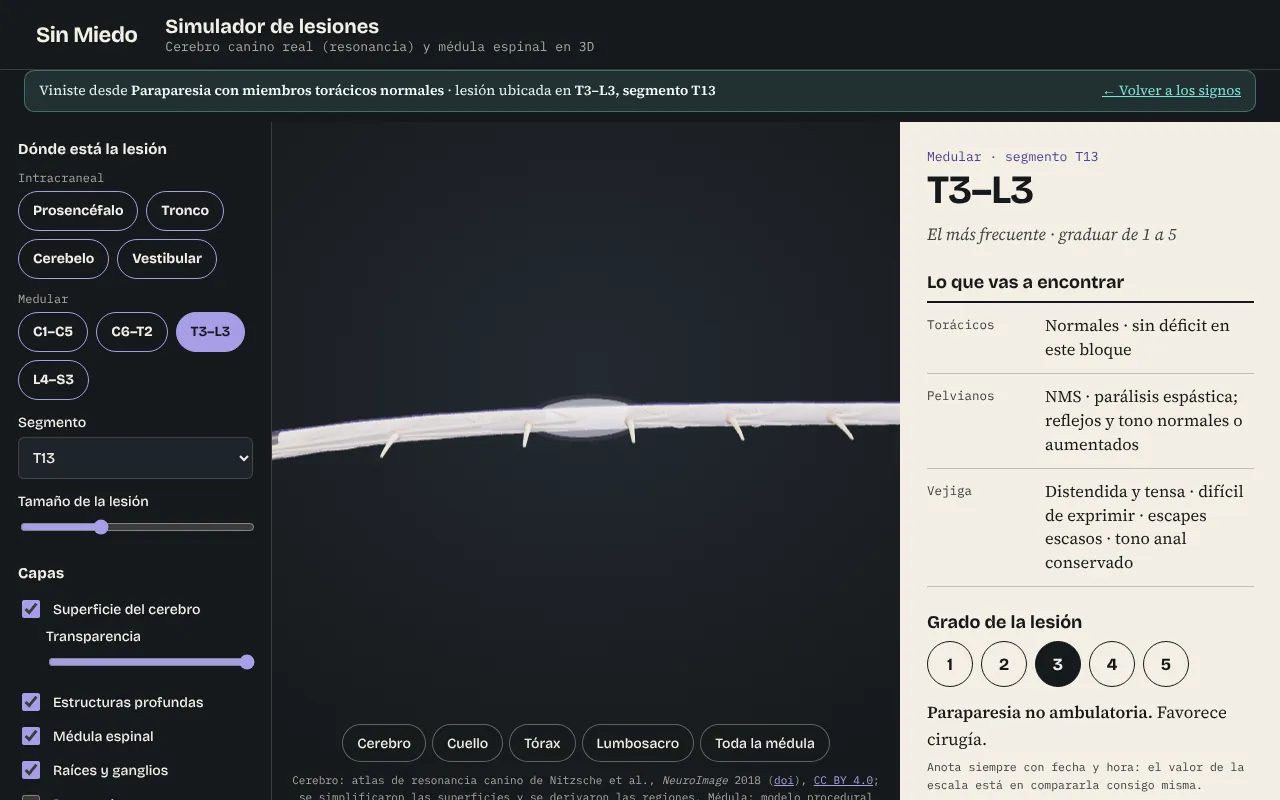 Simulador 3D con una lesión medular T3–L3 grado 3 y los signos esperados